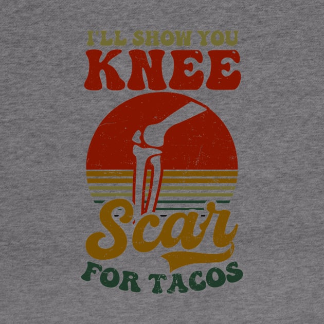 Knee Surgery Shirt | Show Knee Scars For Tacos by Gawkclothing